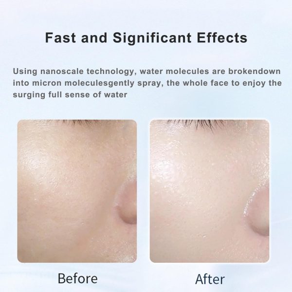 Nano Facial Steamer - Rechargeable & Portable High-Pressure Oxygen Spray, 0.3mm Micro-Mist Skin Hydrator, Essential Water Infusion Facial Spa Treatment, White - Image 4